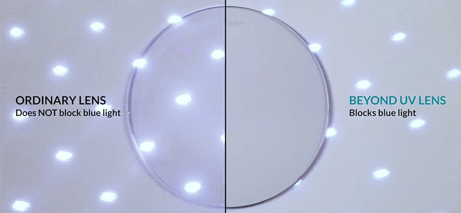 ZENOTTIC Fashion Acetate